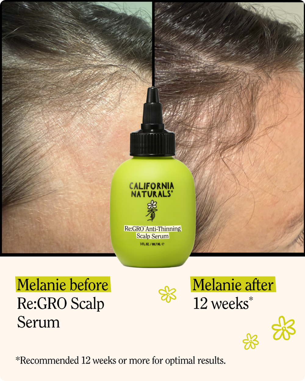 Re:GRO Anti-Thinning Scalp Serum