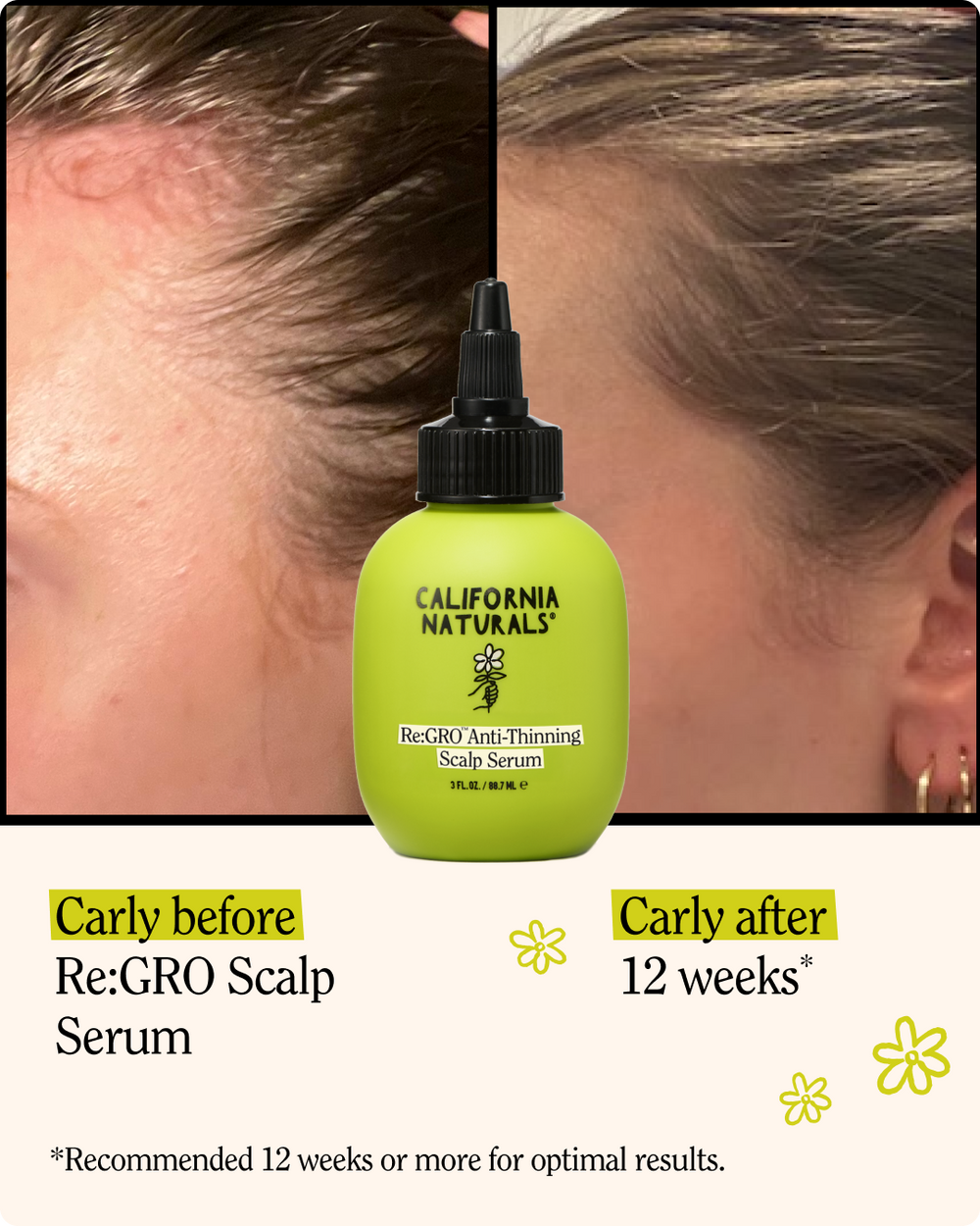 Re:GRO Anti-Thinning Scalp Serum