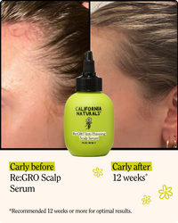 Re:GRO Anti-Thinning Scalp Serum