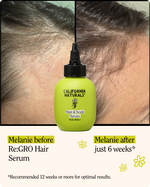 Hair and Scalp Serum