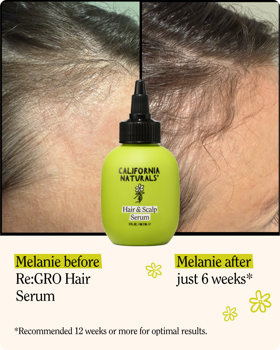 Hair and Scalp Serum