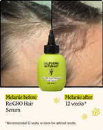 Re:GRO Anti-Thinning Scalp Serum