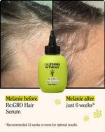 Re:GRO Hair Serum
