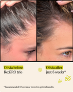 Re:GRO™ Anti-Thinning Collection