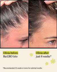 Re:GRO Anti-Thinning Collection