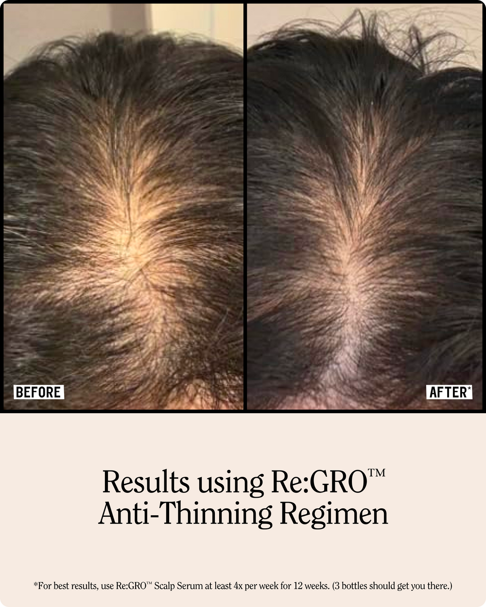 Re:GRO Anti-Thinning Scalp Serum