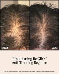 Re:GRO Anti-Thinning Scalp Serum