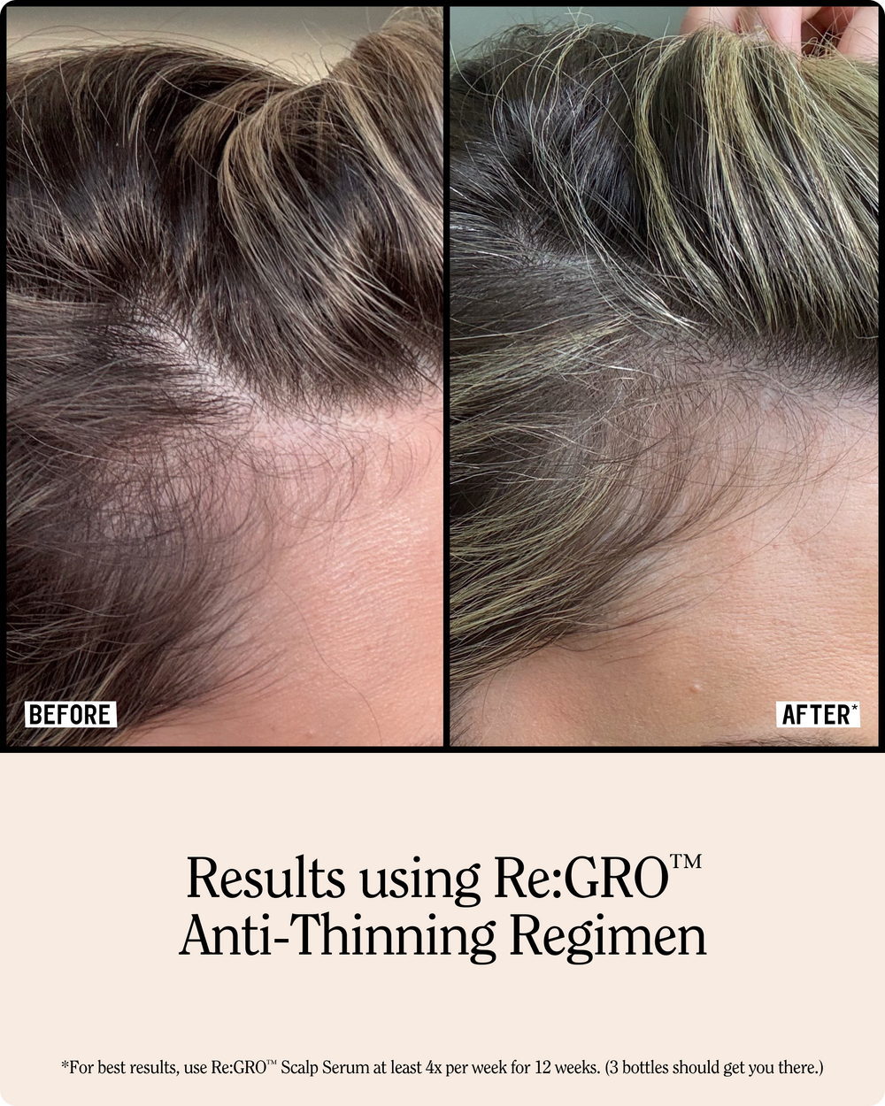 Re:GRO Anti-Thinning Shampoo