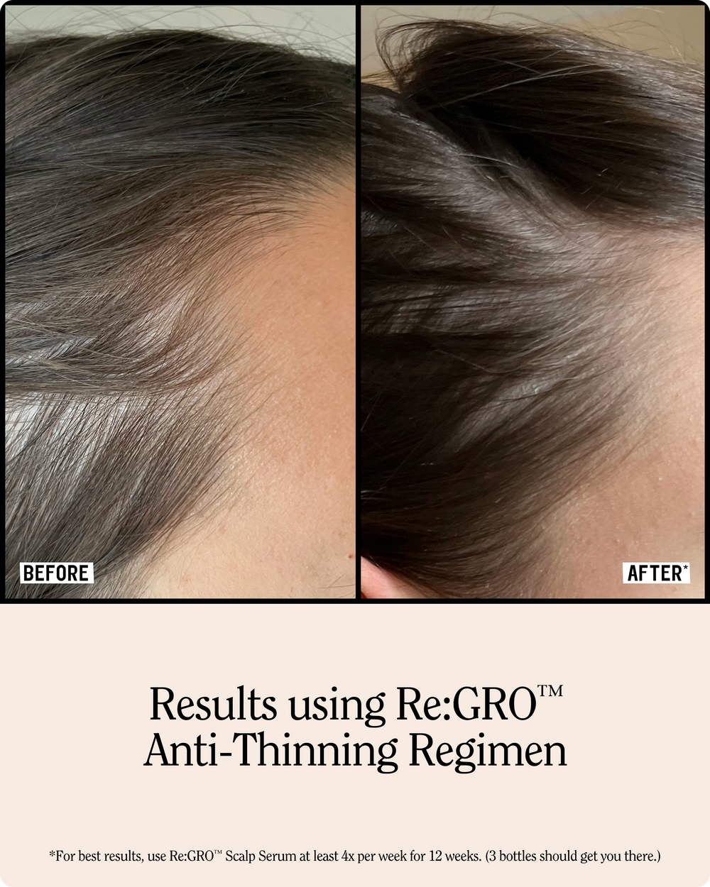 Re:GRO Anti-Thinning Shampoo